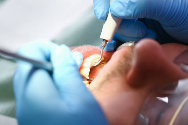 Best Emergency TMJ Treatment in Humble, TX